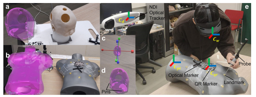 AR + AI pipeline for ioECoG localization