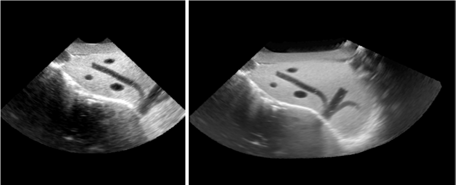 Transformation optimization and image blending for 3D liver ultrasound series stitching